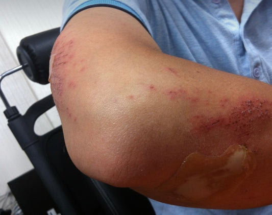 injury